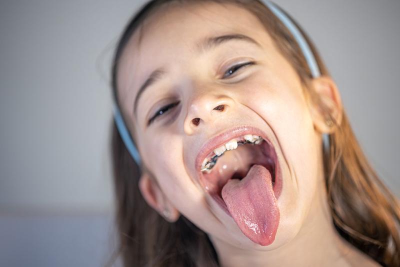 Child gets pediatric dental fillings at comfortable, kid-friendly dentist office in Canton, TX.